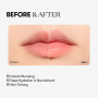 Reedle shot Lip Plumper_Beginner