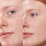 Concealer Balm