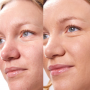 Concealer Balm